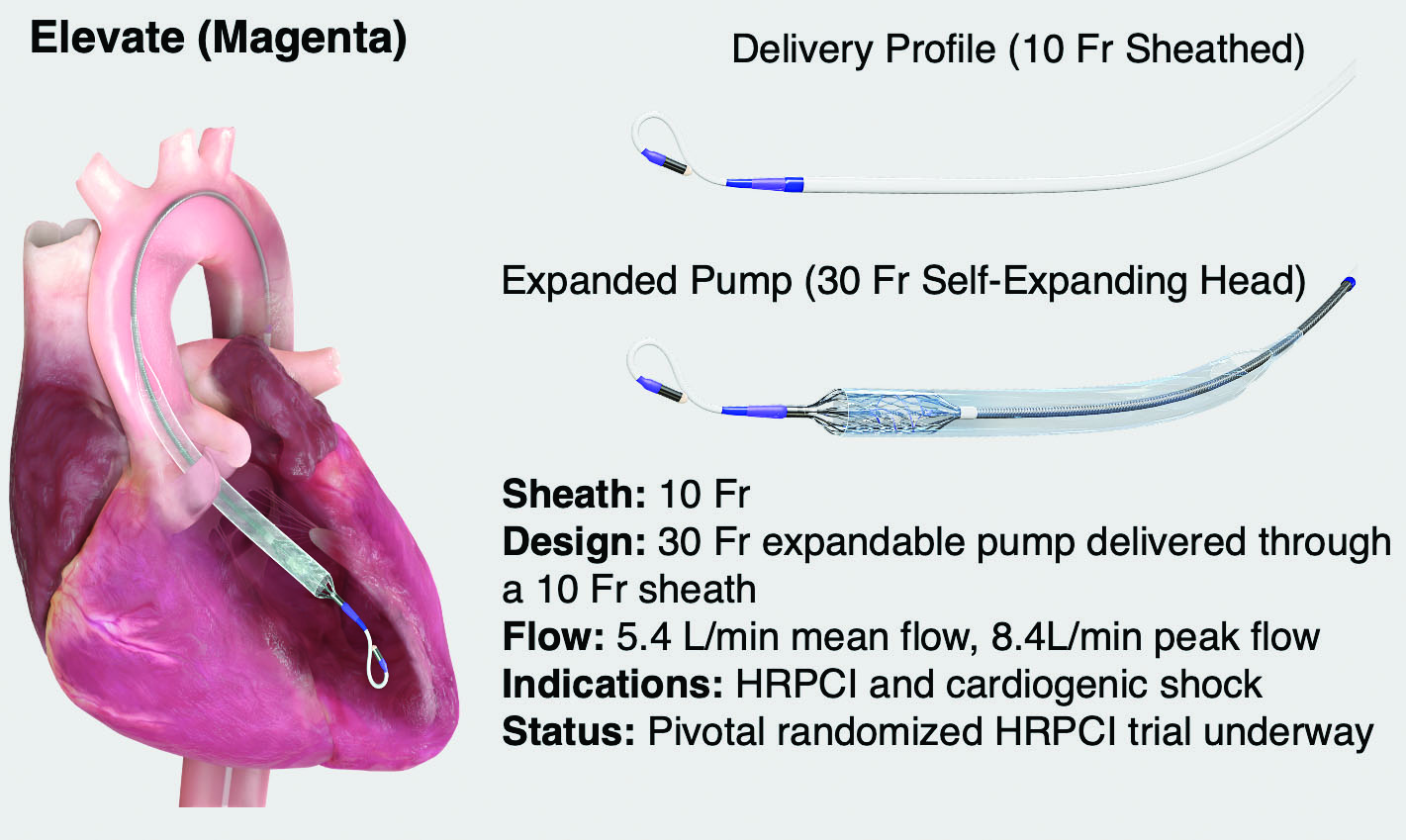 Next-Generation Temporary Mechanical Circulatory Support for High